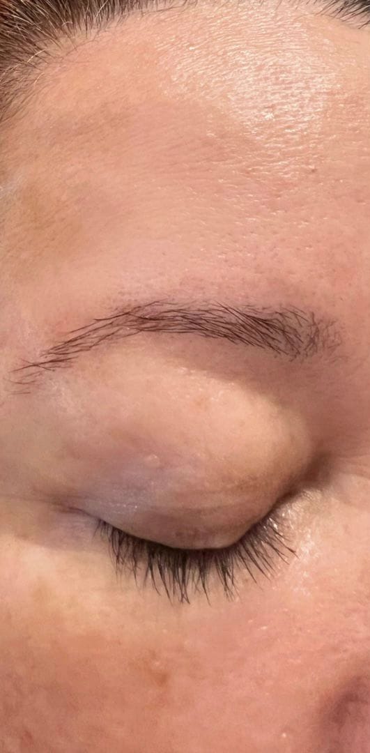 A client’s brow before shaping, uneven and light in color