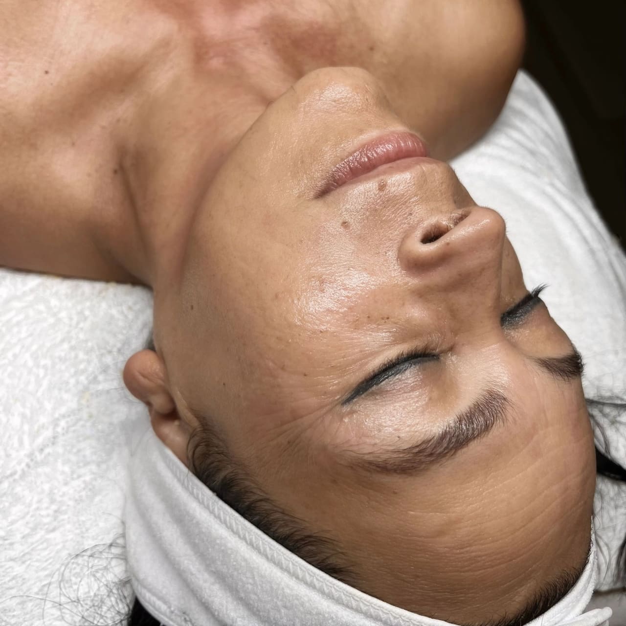 Close-up of clear, hydrated skin immediately after a facial